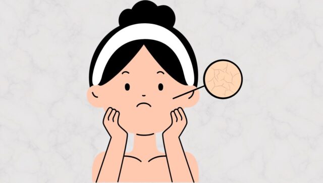 乾燥してカサついた肌が気になっている女性