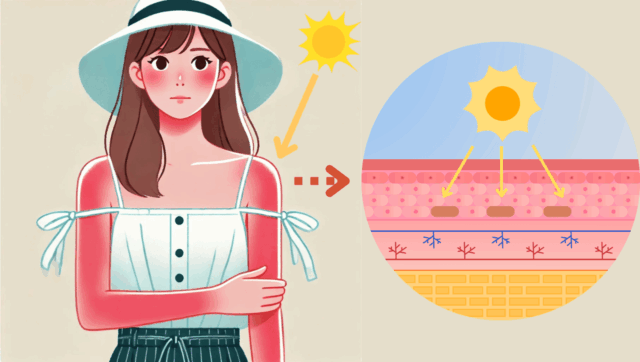 紫外線が肌に当たり、メラニンが生成される様子を示した様子